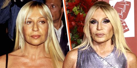 donatella versace before plastic surgery|How Donatella Versace Would Look At 68 If She Never Used.